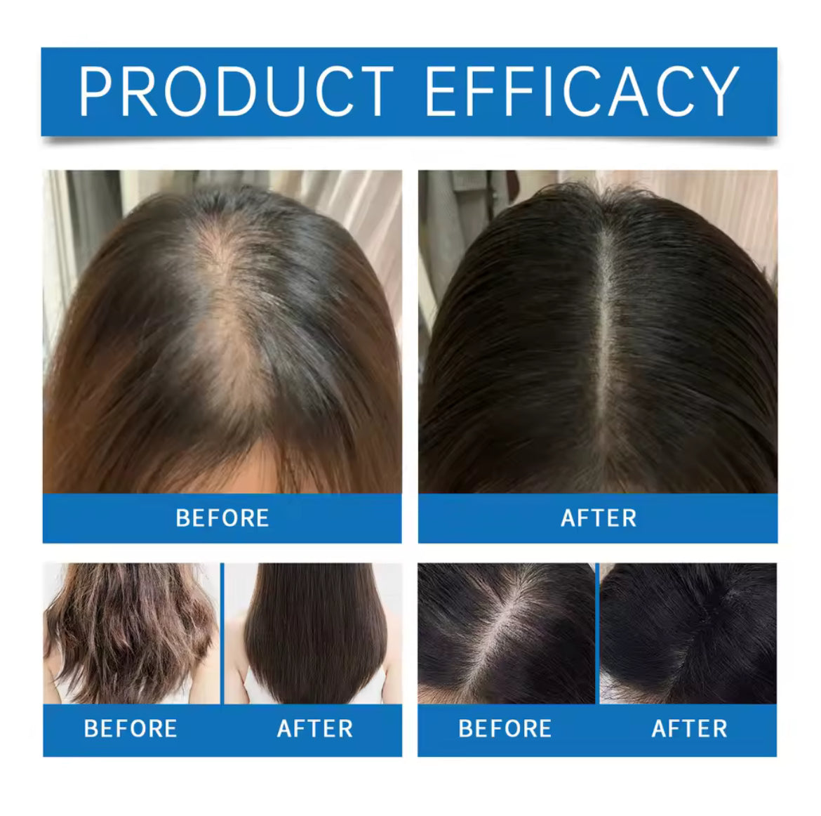 Roll on hair growth syrum