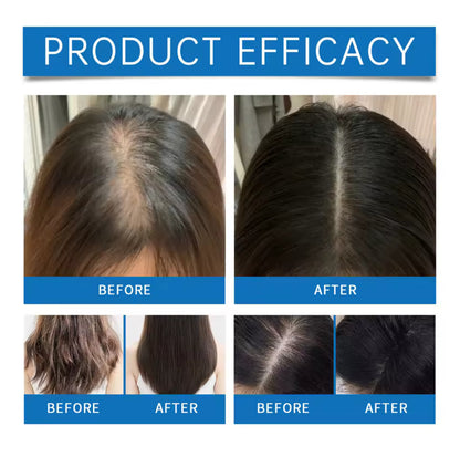 Roll on hair growth syrum